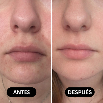 Crema de Ceramidas Illiyoon